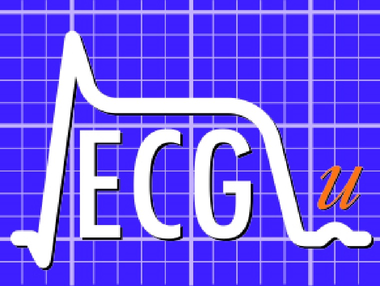 ECG-u